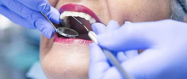 Best Emergency Broken Tooth Repair in Sumner, WA